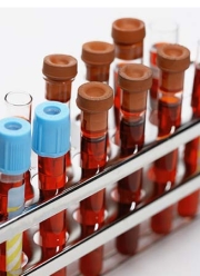 Common Blood Tests