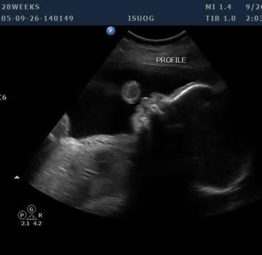 Pregnancy Development: Week 28 Ultrasound