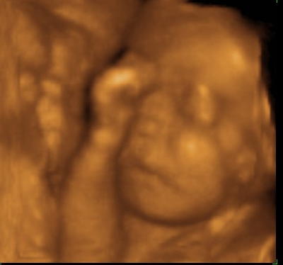 Pregnancy Development: Week 28-2 Ultrasound