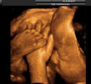 Pregnancy Development: Week 32-2 Ultrasound