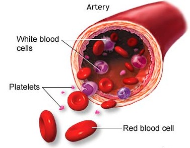 Low Platelet Count During Pregnancy